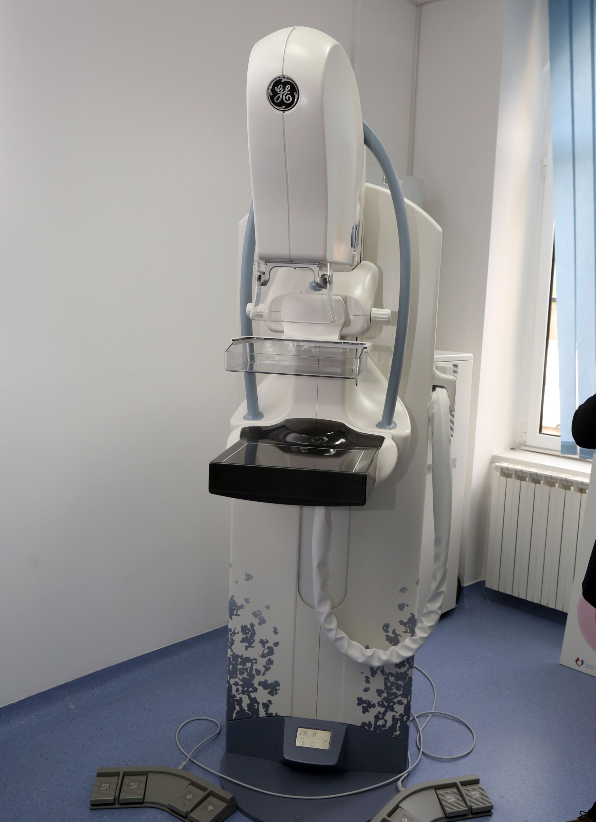 DUGE LISTE ČEKANJA: Splitskom Domu zdravlja nedostaju radiolozi