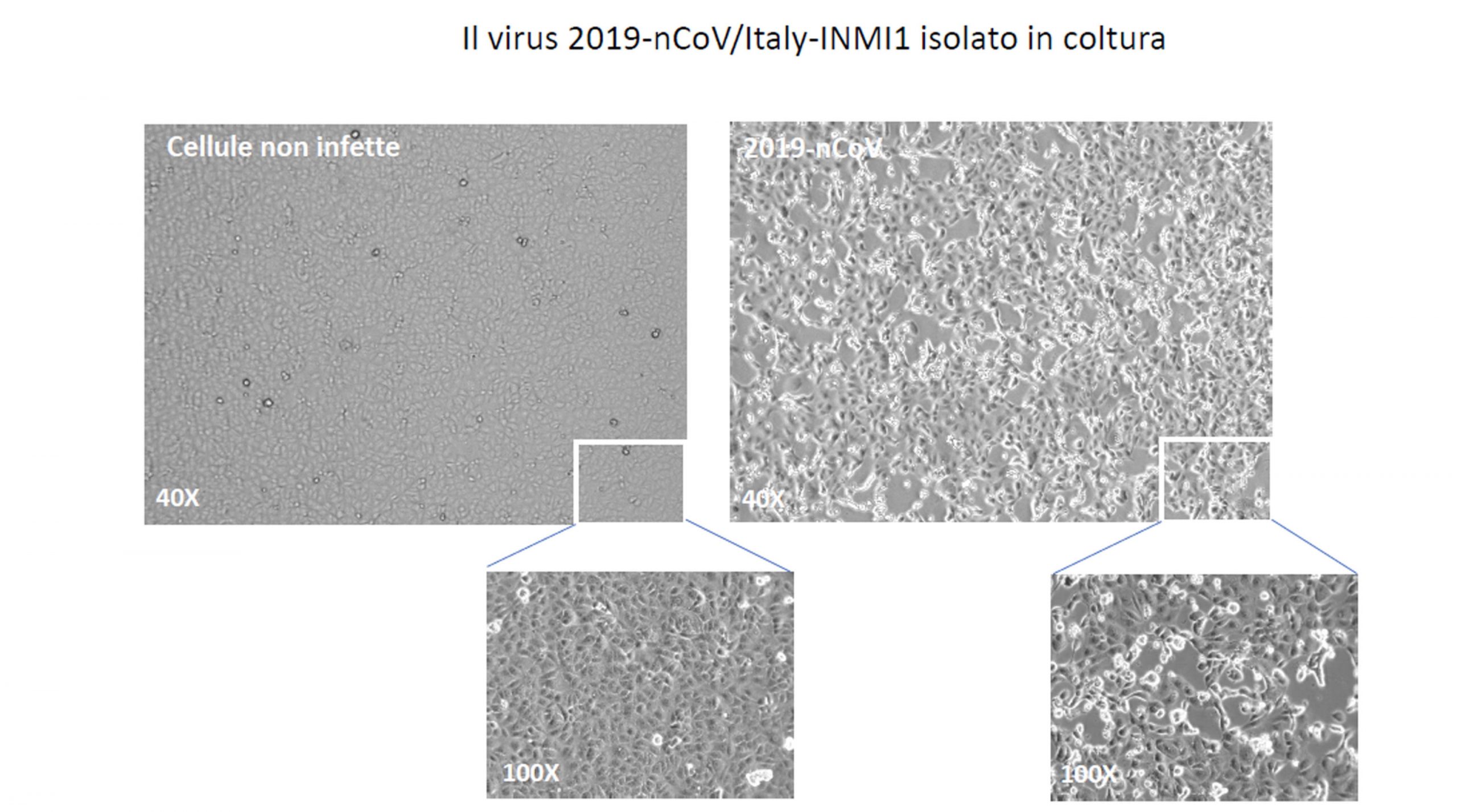epa08187755 An undated handout photo made available by the Lazzaro Spallanzani National Institute for Infectious Diseases (INMI) shows an image of the virus '2019-nCoV/Italy-INMI1' (Viral isolation on cells Vero E6) in Rome, Italy 02 February 2020. 'We have isolated the coronavirus' said the Italian Minister of Health Roberto Speranza during a press conference at the Spallanzani hospital in Rome, Italy, on 02 February 2020. 'Having isolated the virus means many opportunities to study, understand and better verify what you can do it to block the spread. It will be made available to the whole international community. Now it will be easier to treat it.'  EPA/INMI SPALLANZANI HOSPITAL PRESS OFFICE HANDOUT -- BEST QUALITY AVAILABLE -- HANDOUT EDITORIAL USE ONLY/NO SALES