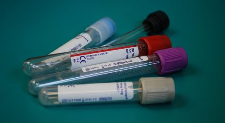 Španjolski klubovi ustupaju svoje testove na koronavirus “onima kojima su potrebniji”
