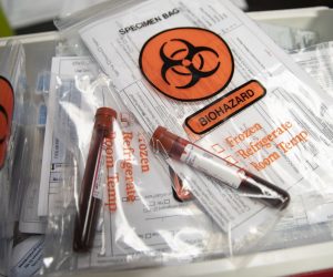 epa08726862 Completed COVID-19 antibody test specimens with for testing in Glen Burnie, Maryland, USA, 07 October 2020. Emergency Medical Professionals continue to battle the COVID-19 Pandemic as the number of cases and deaths continues to rise globally.  EPA/ALEX EDELMAN