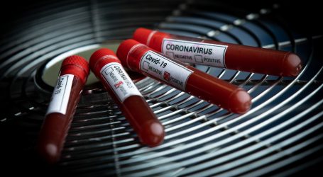 HZZO objavio cijenu antigenskog testiranja na koronavirus