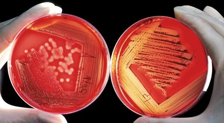 U SAD-u otkrivena smrtonosna bakterija koja uzrokuje melioidozu – CDC izdao upozorenje!