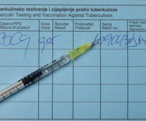 04.05.2022., Zagreb - Ilustracija -  tuberkuloza.
Photo: Davor Puklavec/PIXSELL Photo: Davor Puklavec/PIXSELL