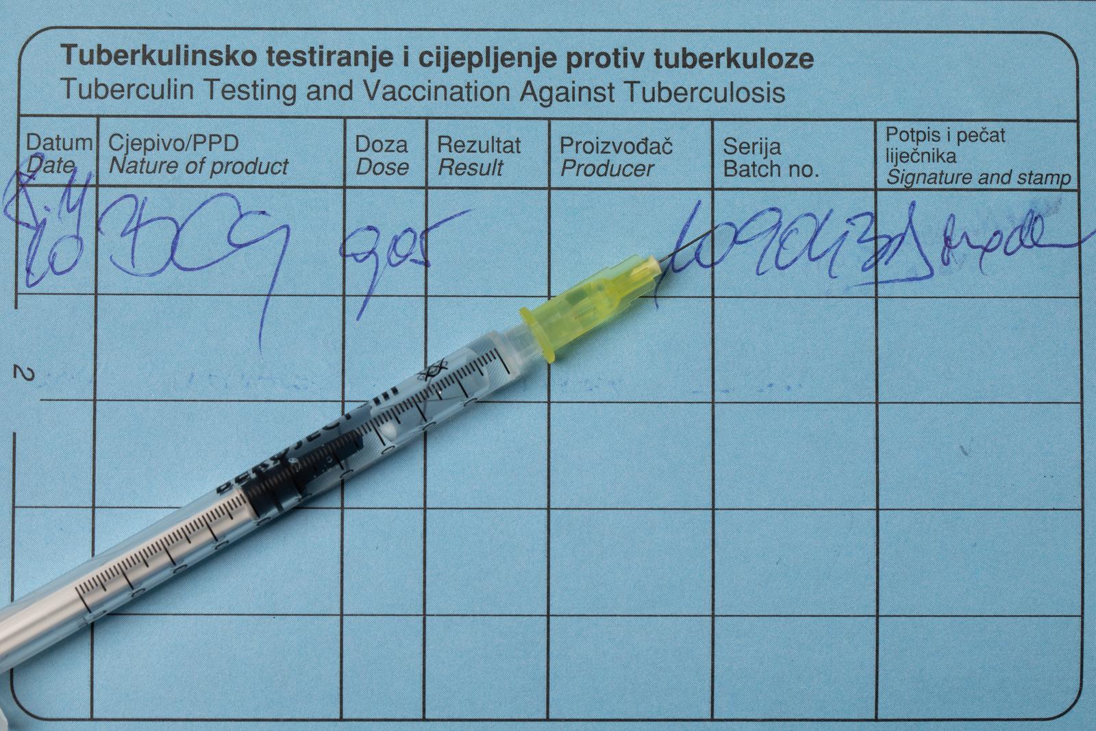 04.05.2022., Zagreb - Ilustracija -  tuberkuloza.
Photo: Davor Puklavec/PIXSELL Photo: Davor Puklavec/PIXSELL